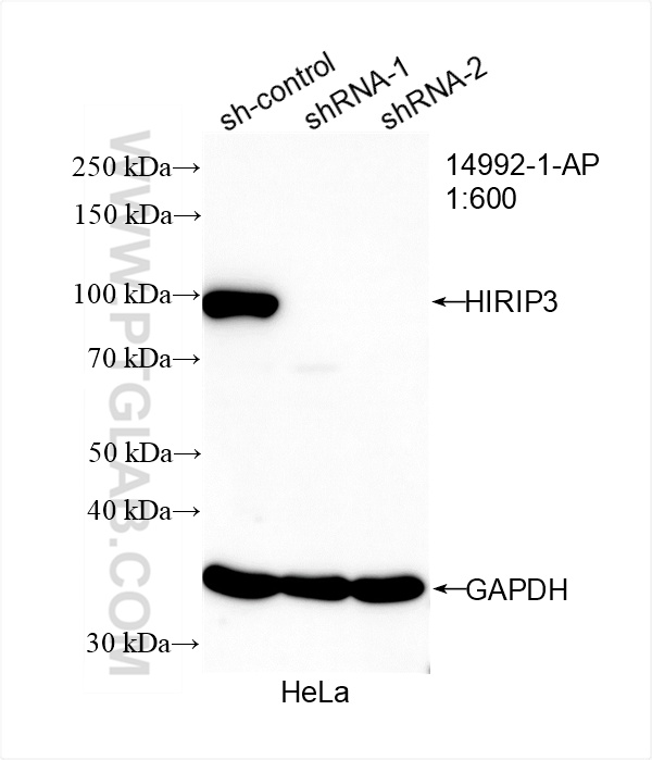 WB result of HIRIP3 antibody (14992-1-AP; 1:600; incubated at room temperature for 1.5 hours) with sh-Control and sh-HIRIP3 transfected HeLa cells. WB analysis of HeLa using 14992-1-AP