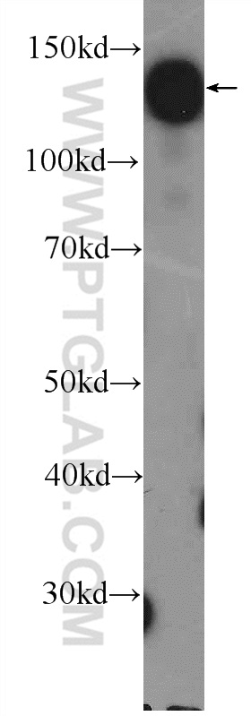 WB analysis of K-562 using 26018-1-AP