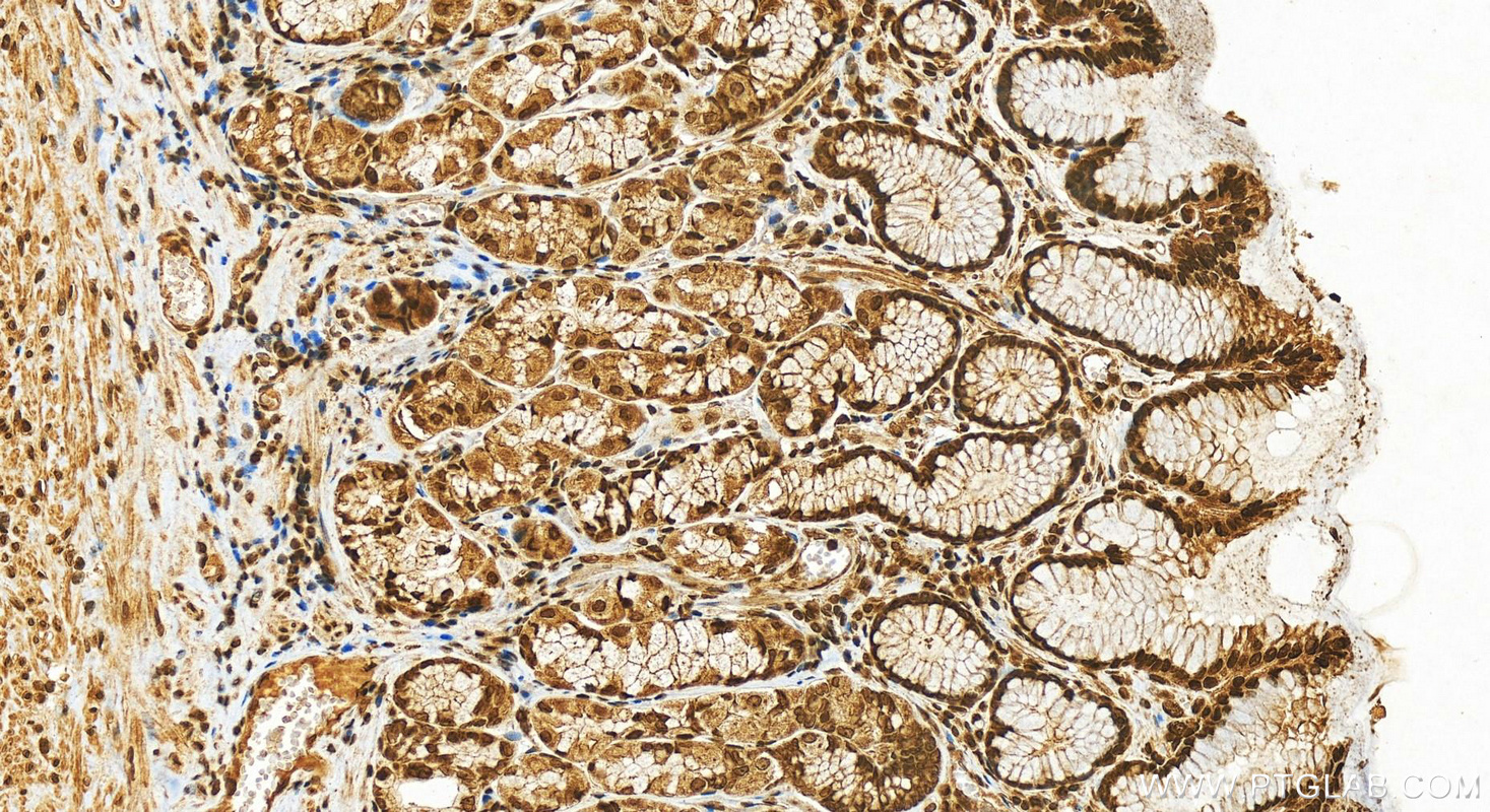 IHC staining of human stomach using 18201-1-AP