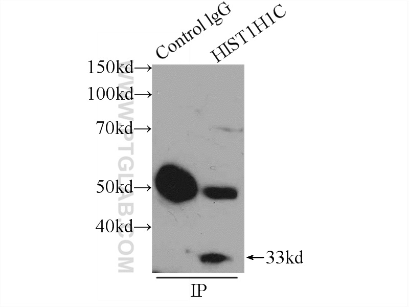 IP experiment of HeLa using 19649-1-AP