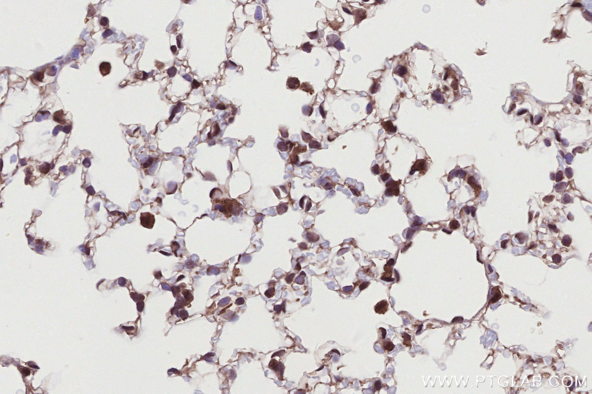IHC staining of mouse lung using 15953-1-AP IHC staining of mouse lung using 15953-1-AP