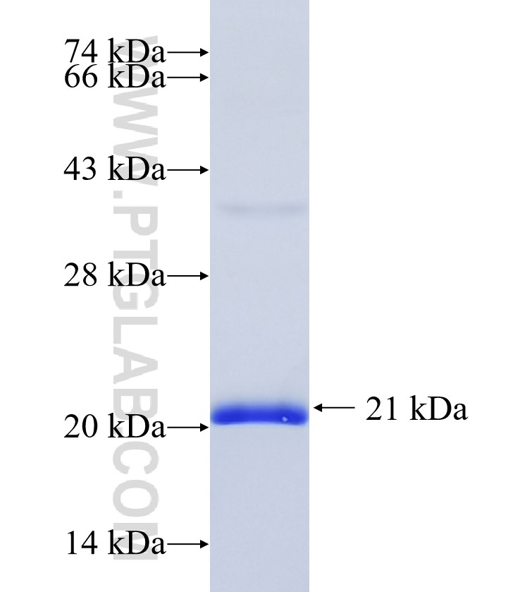 HIST1H2BA fusion protein Ag33993 SDS-PAGE HIST1H2BA fusion protein Ag33993 SDS-PAGE