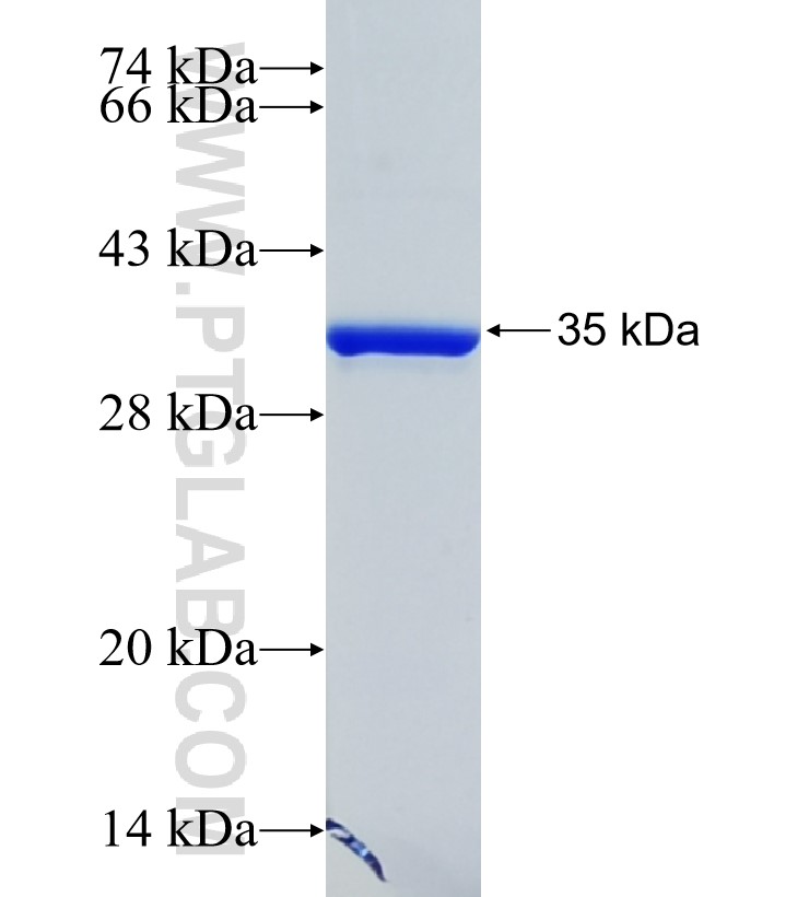 HIST1H2BC fusion protein Ag0327 SDS-PAGE HIST1H2BC fusion protein Ag0327 SDS-PAGE