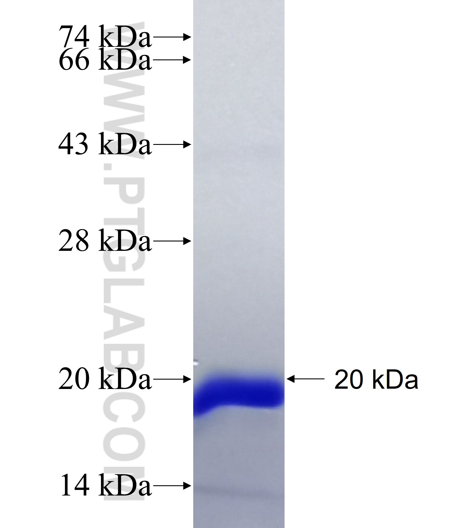 HIST1H2BD fusion protein Ag38752 SDS-PAGE HIST1H2BD fusion protein Ag38752 SDS-PAGE