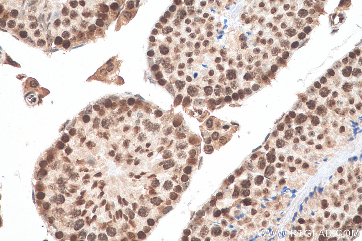 IHC staining of mouse testis using 68503-1-Ig (same clone as 68503-1-PBS)
