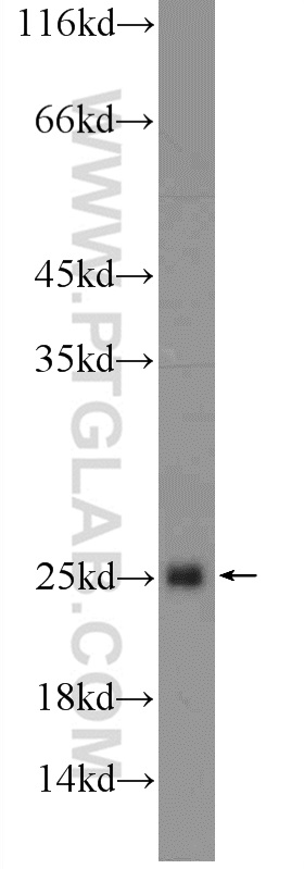 HIST1H3D Polyclonal antibody