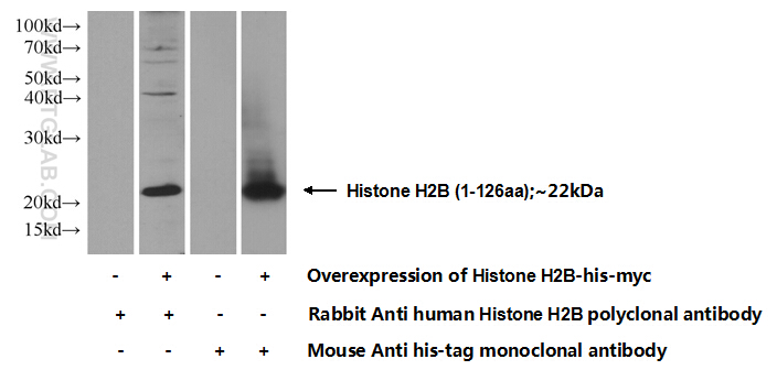 Histone H2B Polyclonal antibody