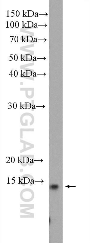 WB analysis of HEK-293T using 27740-1-AP