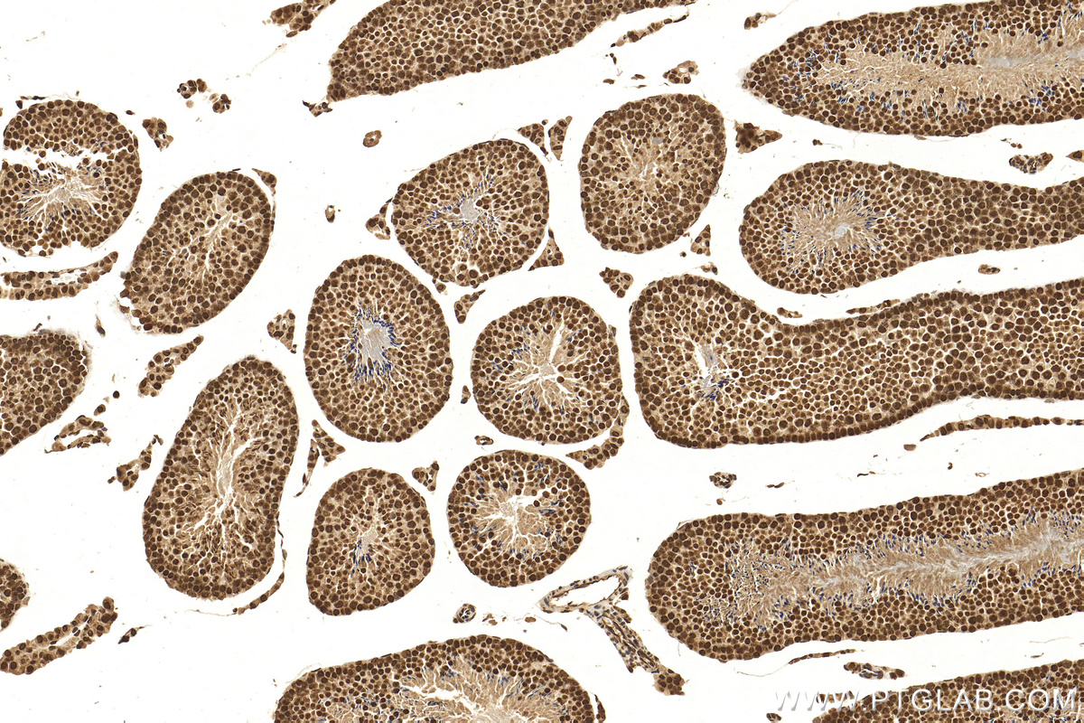 IHC staining of mouse testis using 18064-1-AP