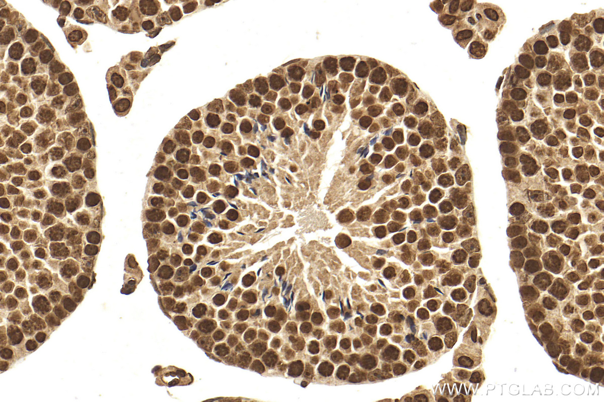 IHC staining of mouse testis using 18064-1-AP