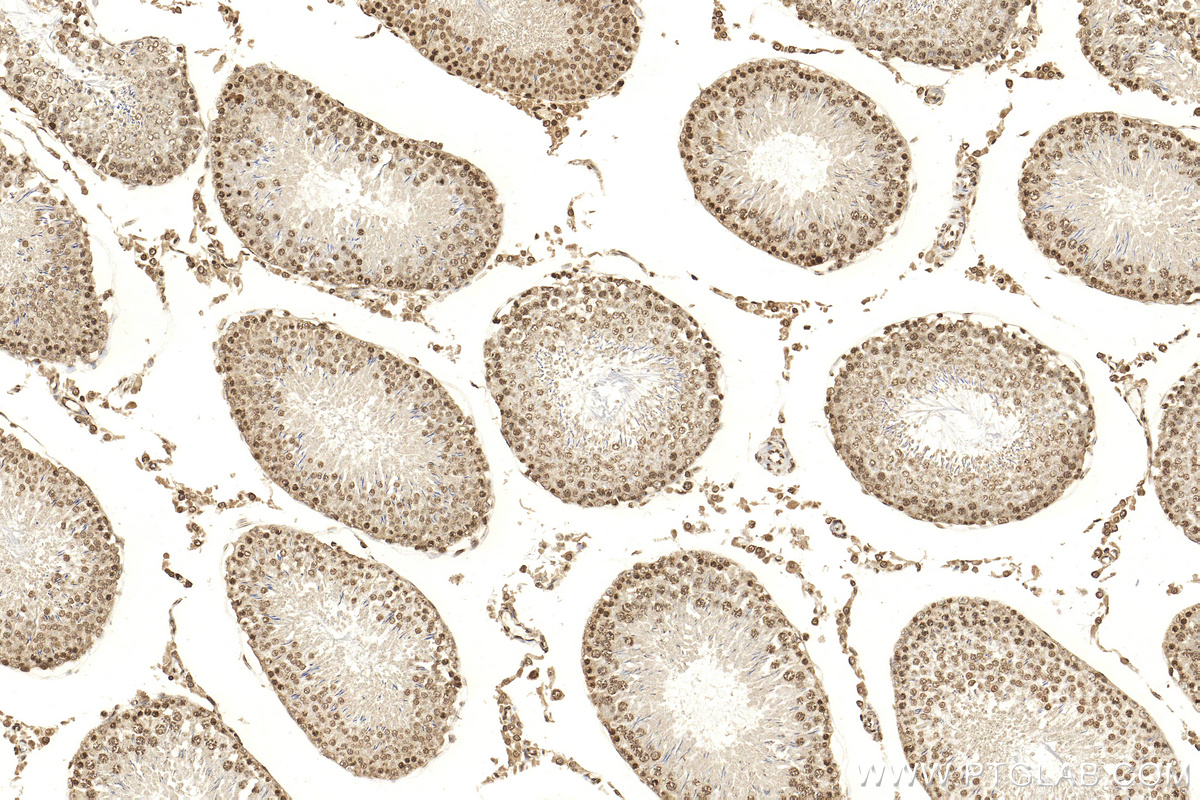 IHC staining of rat testis using 18064-1-AP