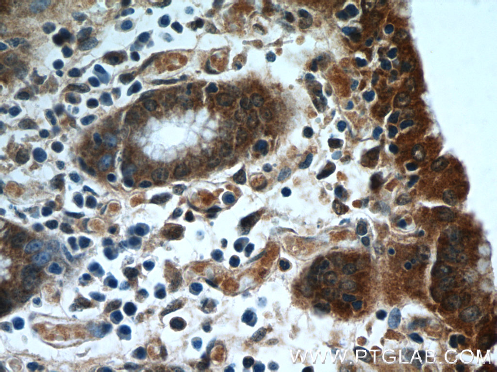 IHC staining of human stomach using 25168-1-AP (same clone as 25168-1-PBS)