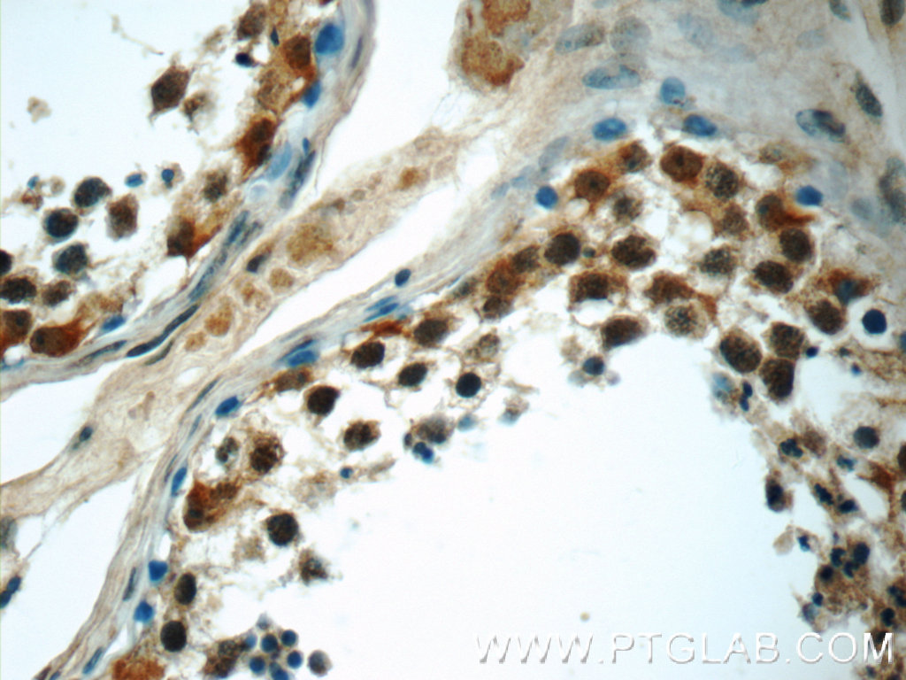 IHC staining of human testis using 25168-1-AP (same clone as 25168-1-PBS)