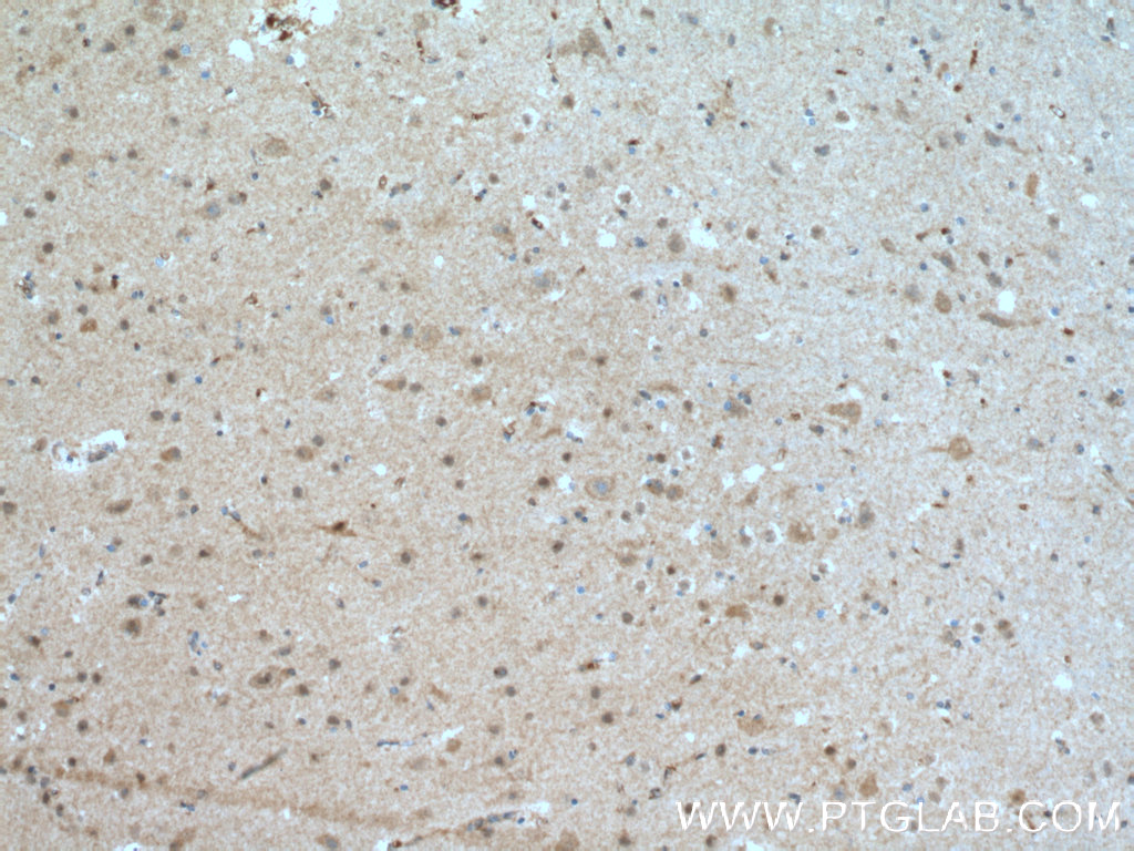 IHC staining of human brain using 15283-1-AP