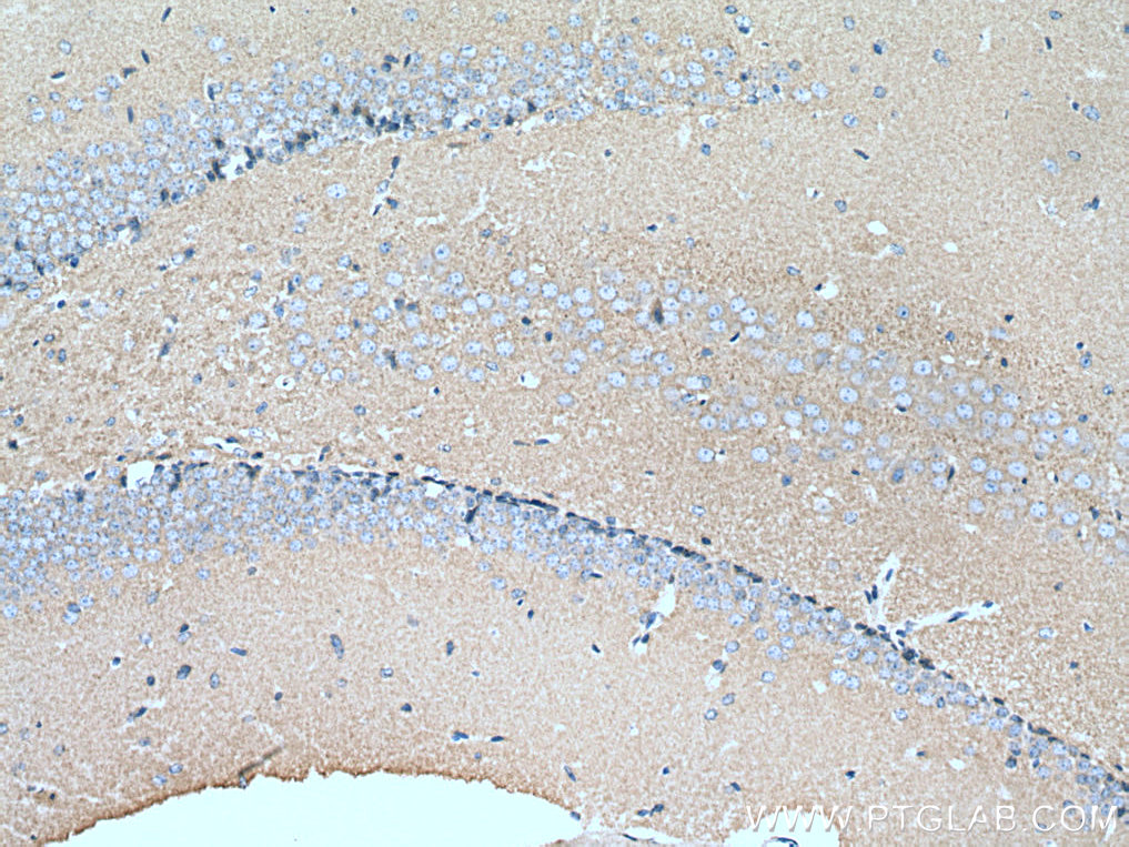 IHC staining of mouse brain using 19662-1-AP