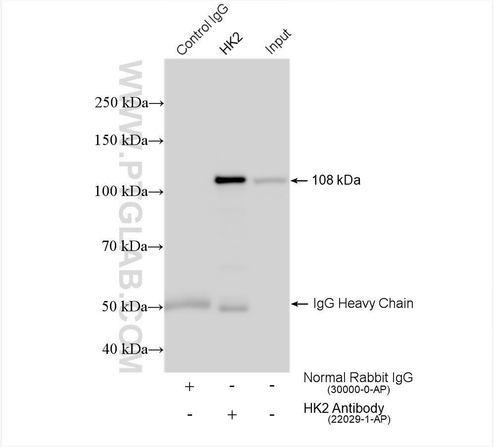 IP experiment of HeLa using 22029-1-AP