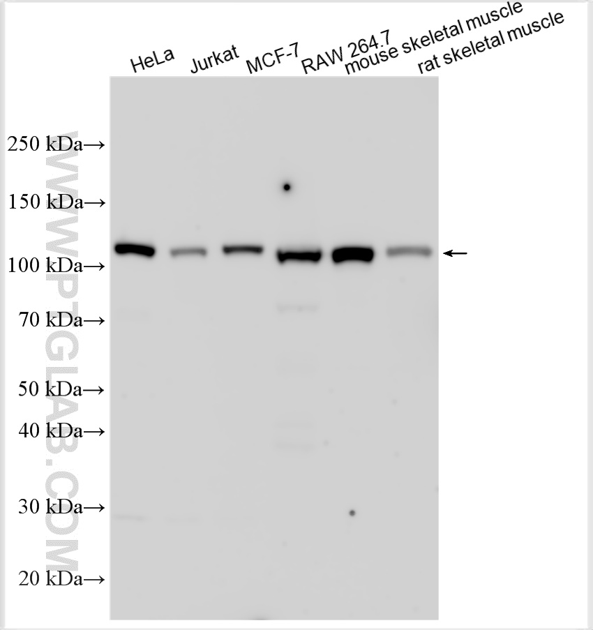 WB analysis using 22029-1-AP