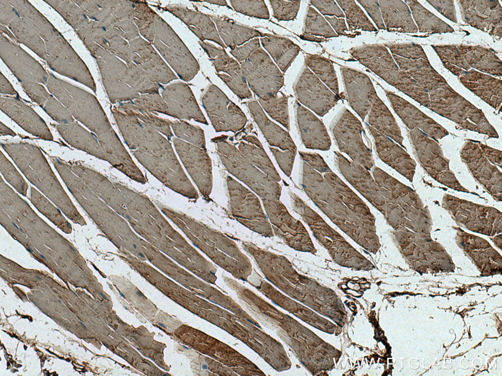 IHC staining of mouse skeletal muscle using 66974-1-Ig (same clone as 66974-1-PBS)