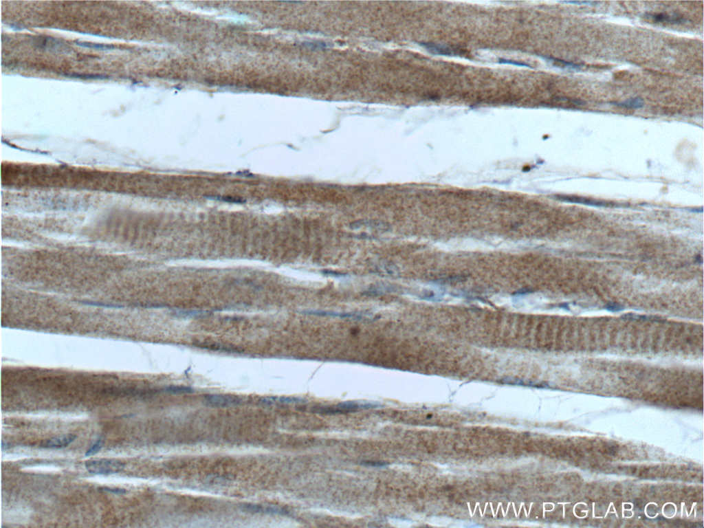 IHC staining of human skeletal muscle using 25874-1-AP