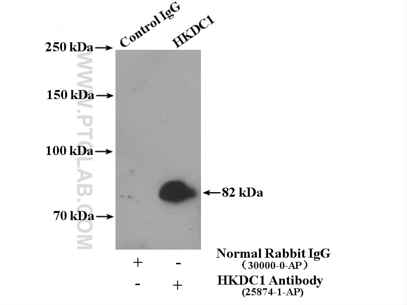 IP experiment of mouse skeletal muscle using 25874-1-AP