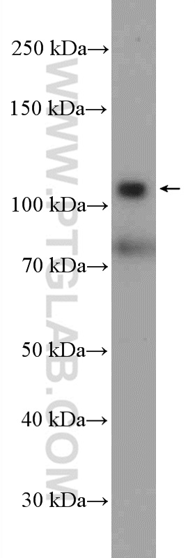 WB analysis of A549 using 25874-1-AP