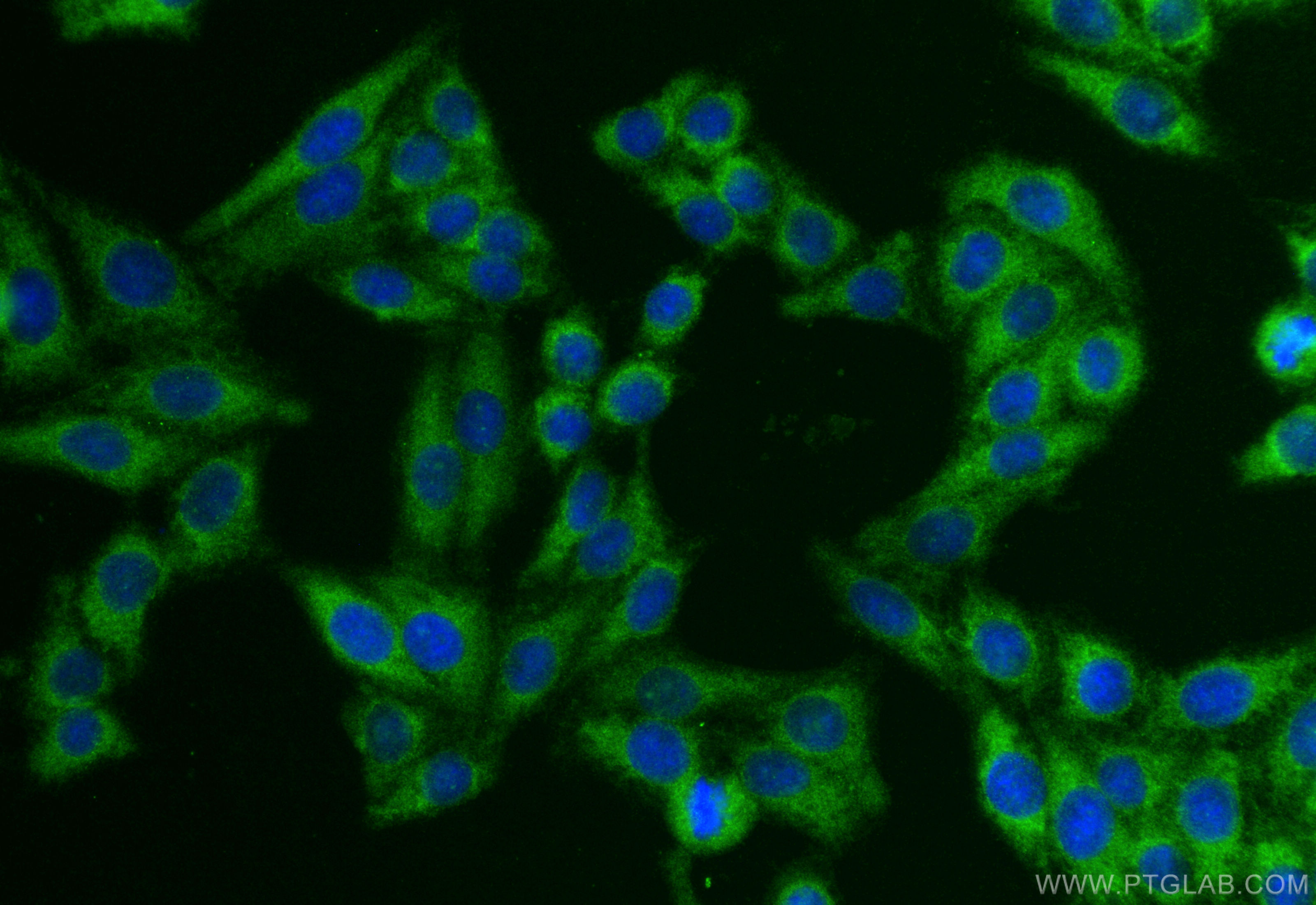 IF Staining of HepG2 using 55383-1-AP