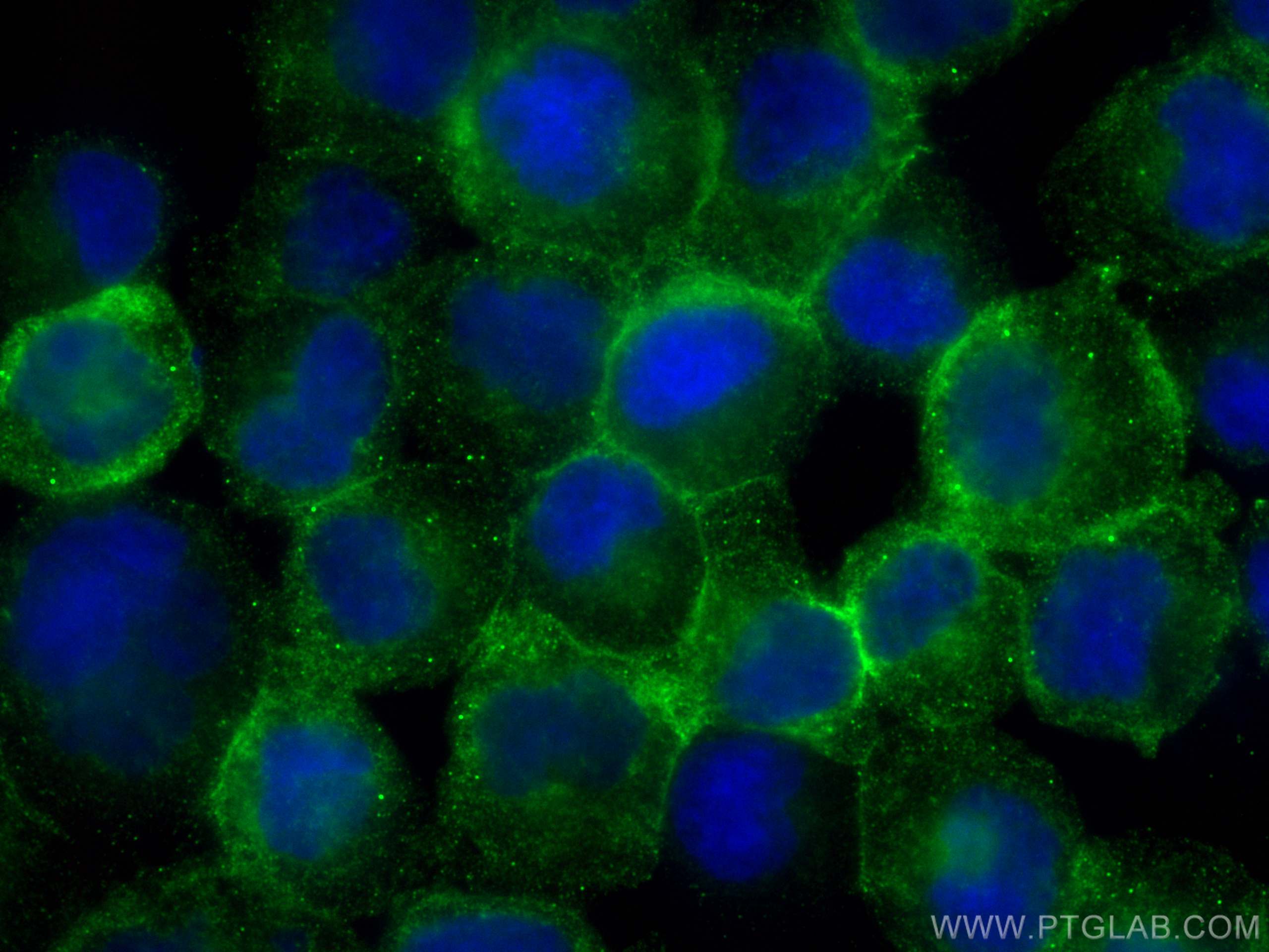 IF Staining of Raji using 66013-1-Ig (same clone as 66013-1-PBS)
