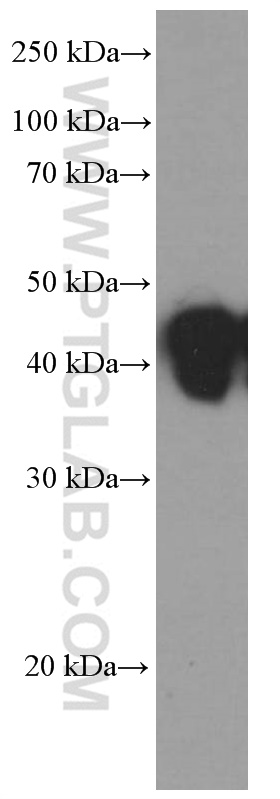 HLA class I ABC Monoclonal antibody