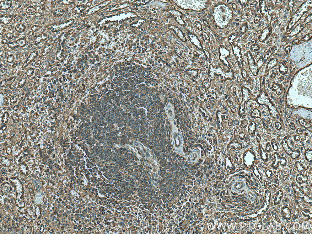 IHC staining of human spleen using 17260-1-AP