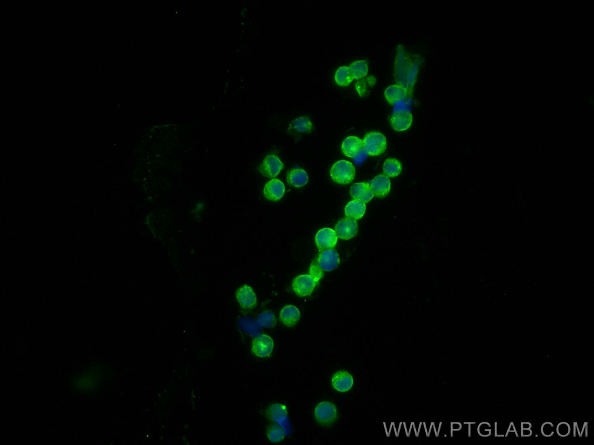 IF Staining of Raji using 21704-1-AP