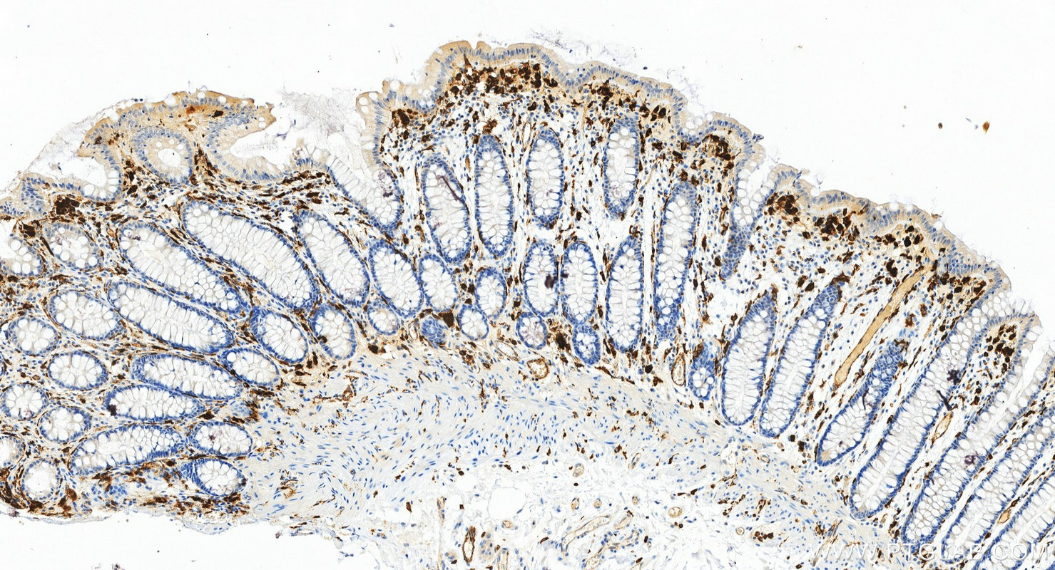 IHC staining of human colon using 82922-1-RR (same clone as 82922-1-PBS) IHC staining of human colon using 82922-1-RR (same clone as 82922-1-PBS)