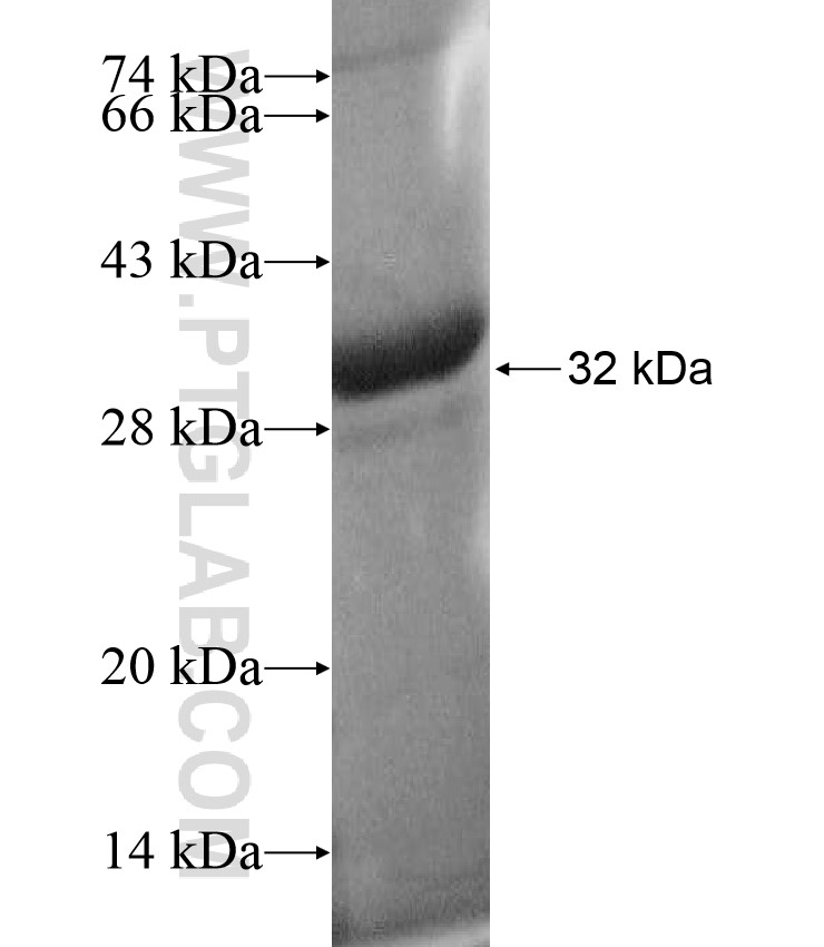 HLA-DMB fusion protein Ag17507 SDS-PAGE HLA-DMB fusion protein Ag17507 SDS-PAGE