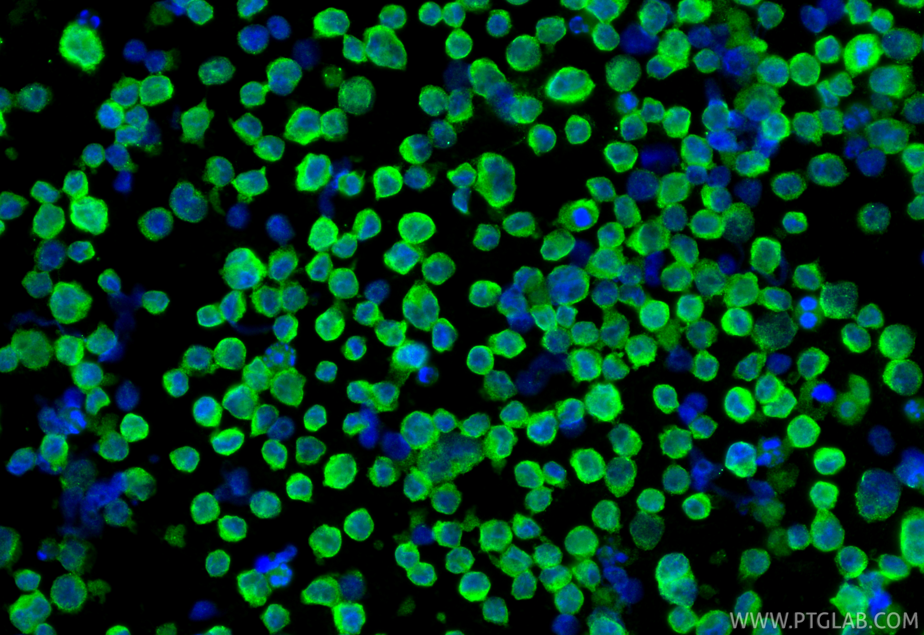 IF Staining of Raji using 16918-1-AP IF Staining of Raji using 16918-1-AP