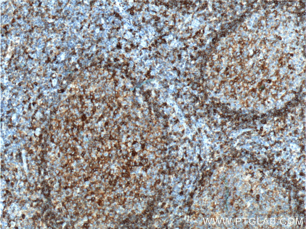 HLA-DQA1
