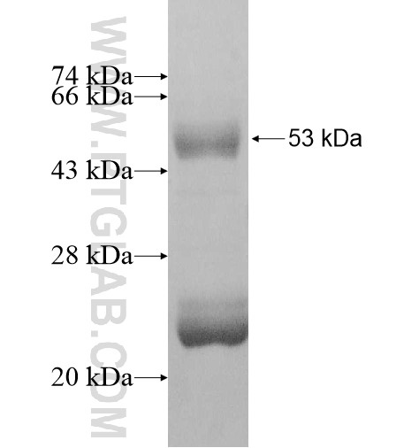 HLA-DQB2 fusion protein Ag11284 SDS-PAGE
