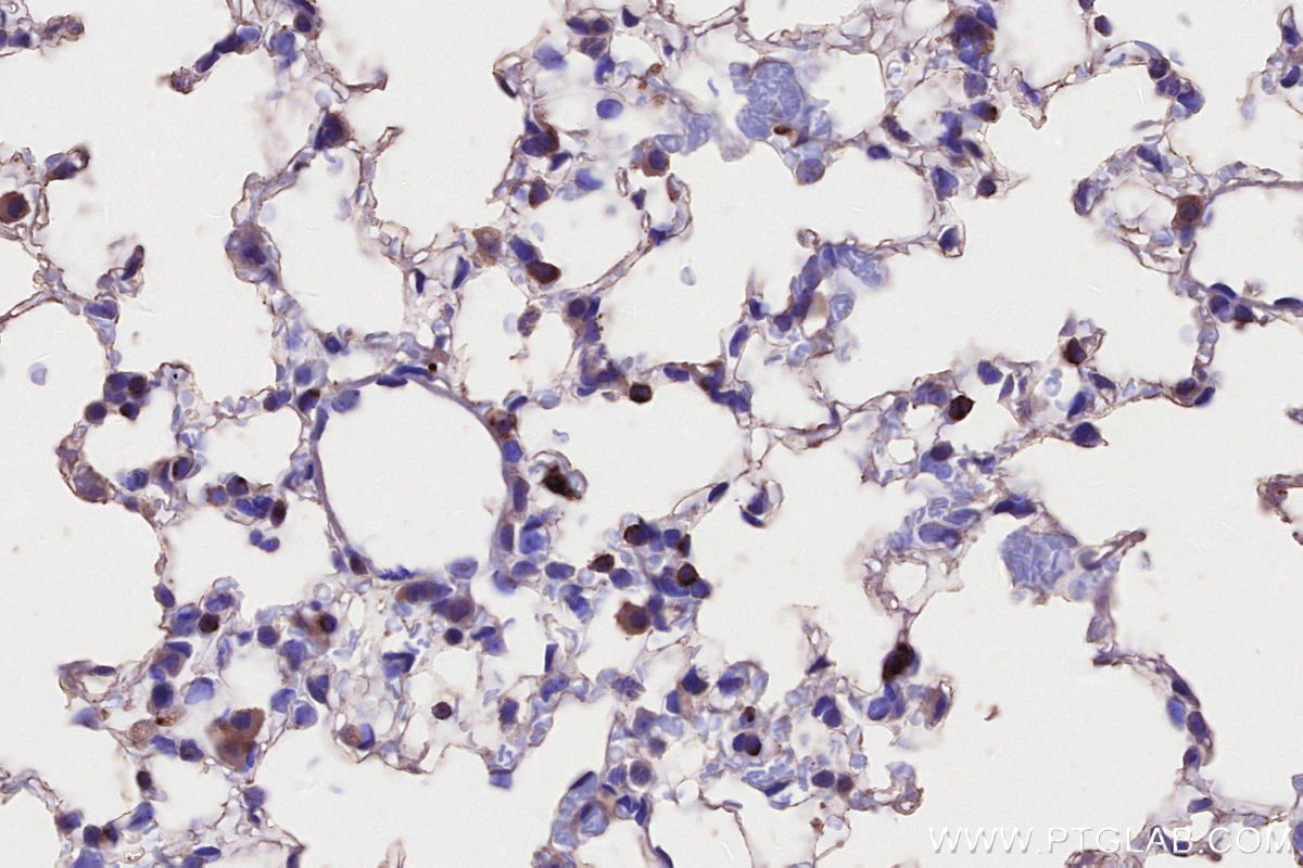 IHC staining of mouse lung using 68543-1-Ig IHC staining of mouse lung using 68543-1-Ig