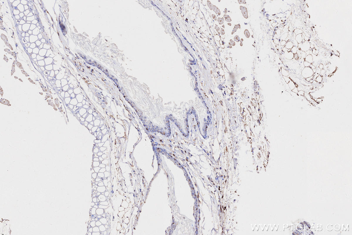 IHC staining of mouse skin using 68543-1-Ig IHC staining of mouse skin using 68543-1-Ig