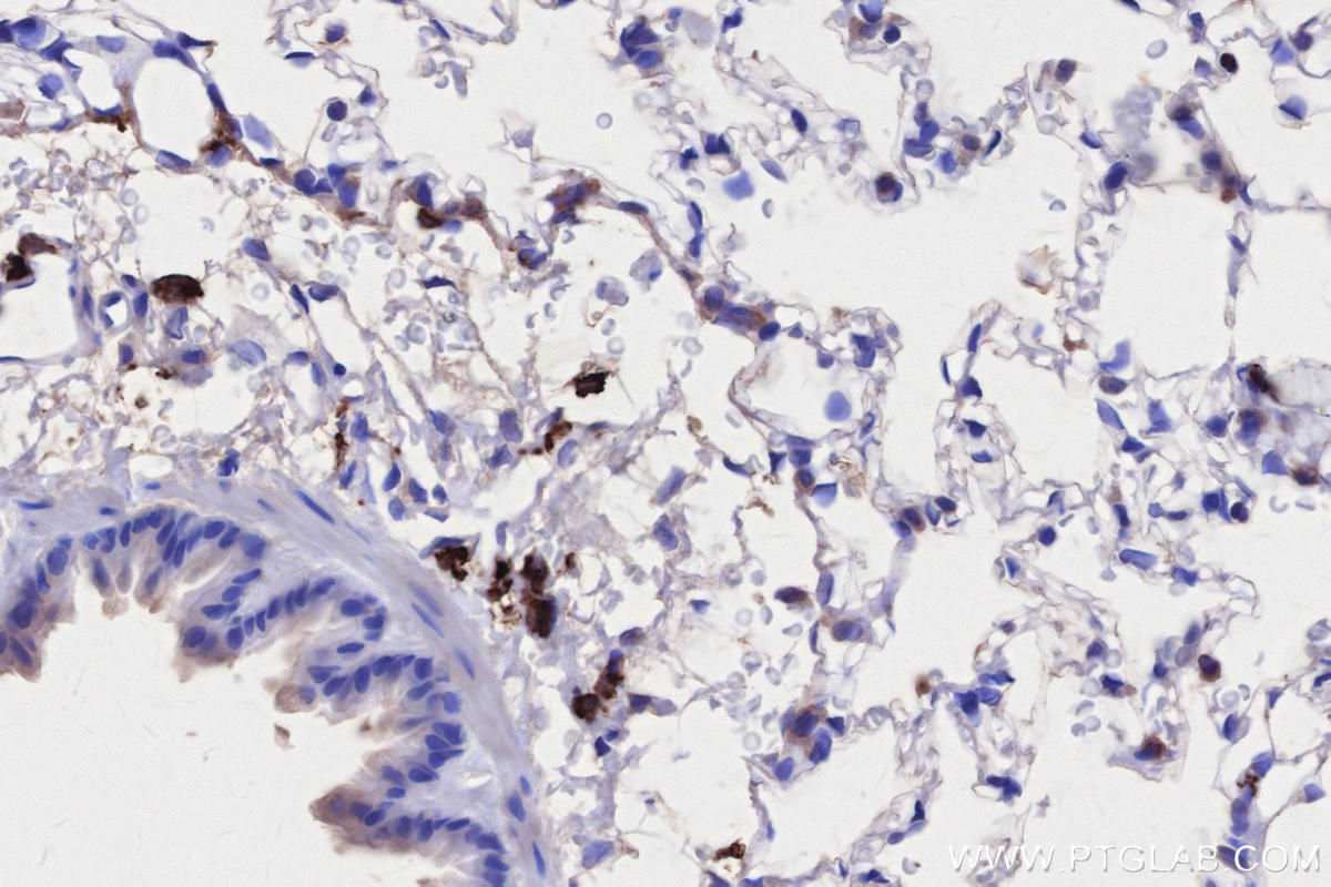IHC staining of rat lung using 68543-1-Ig IHC staining of rat lung using 68543-1-Ig