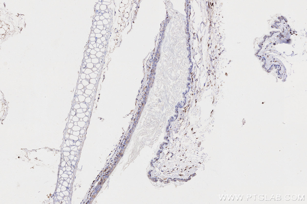 IHC staining of mouse skin using 68543-1-Ig IHC staining of mouse skin using 68543-1-Ig