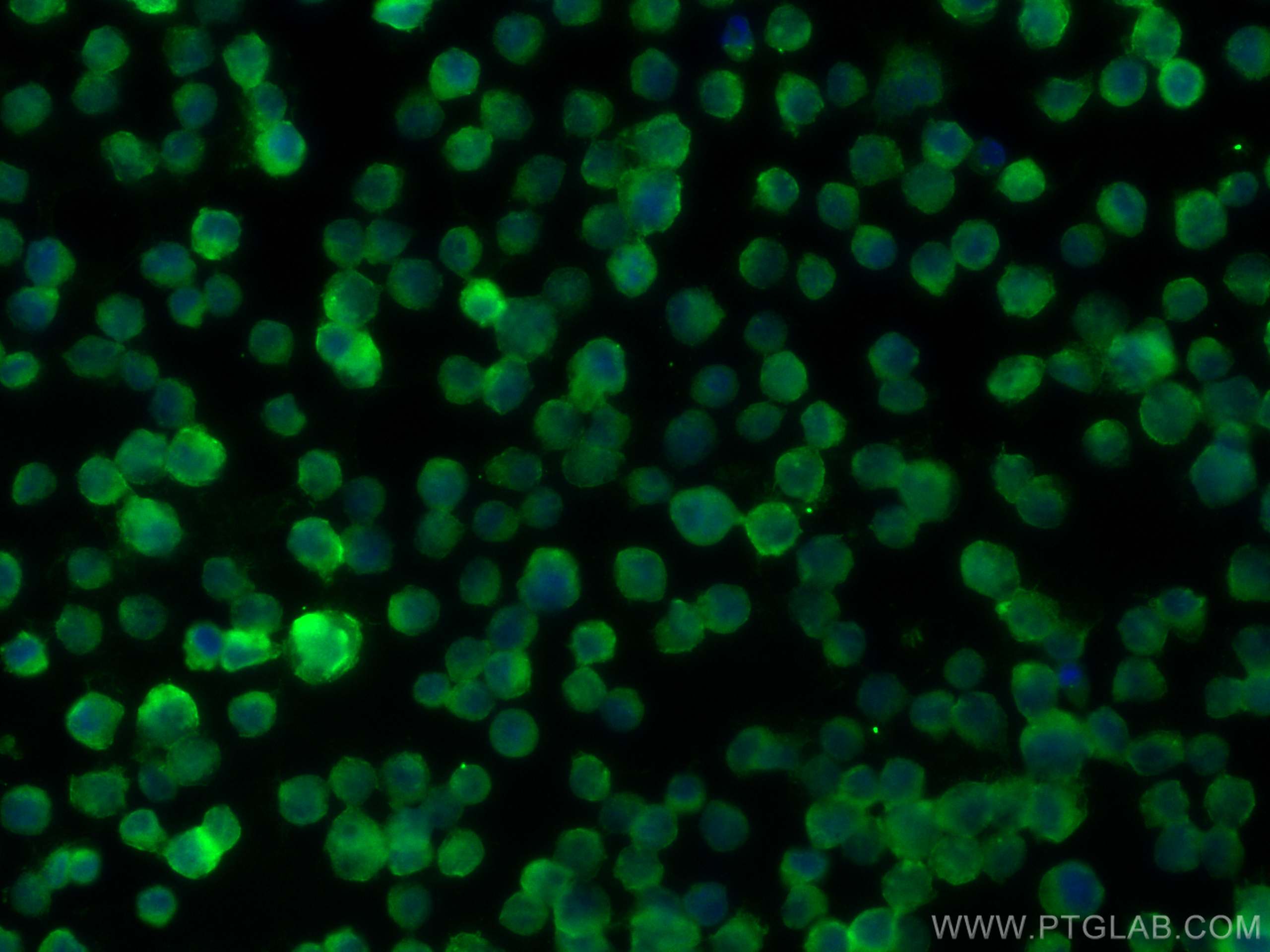 IF Staining of Raji using 15862-1-AP