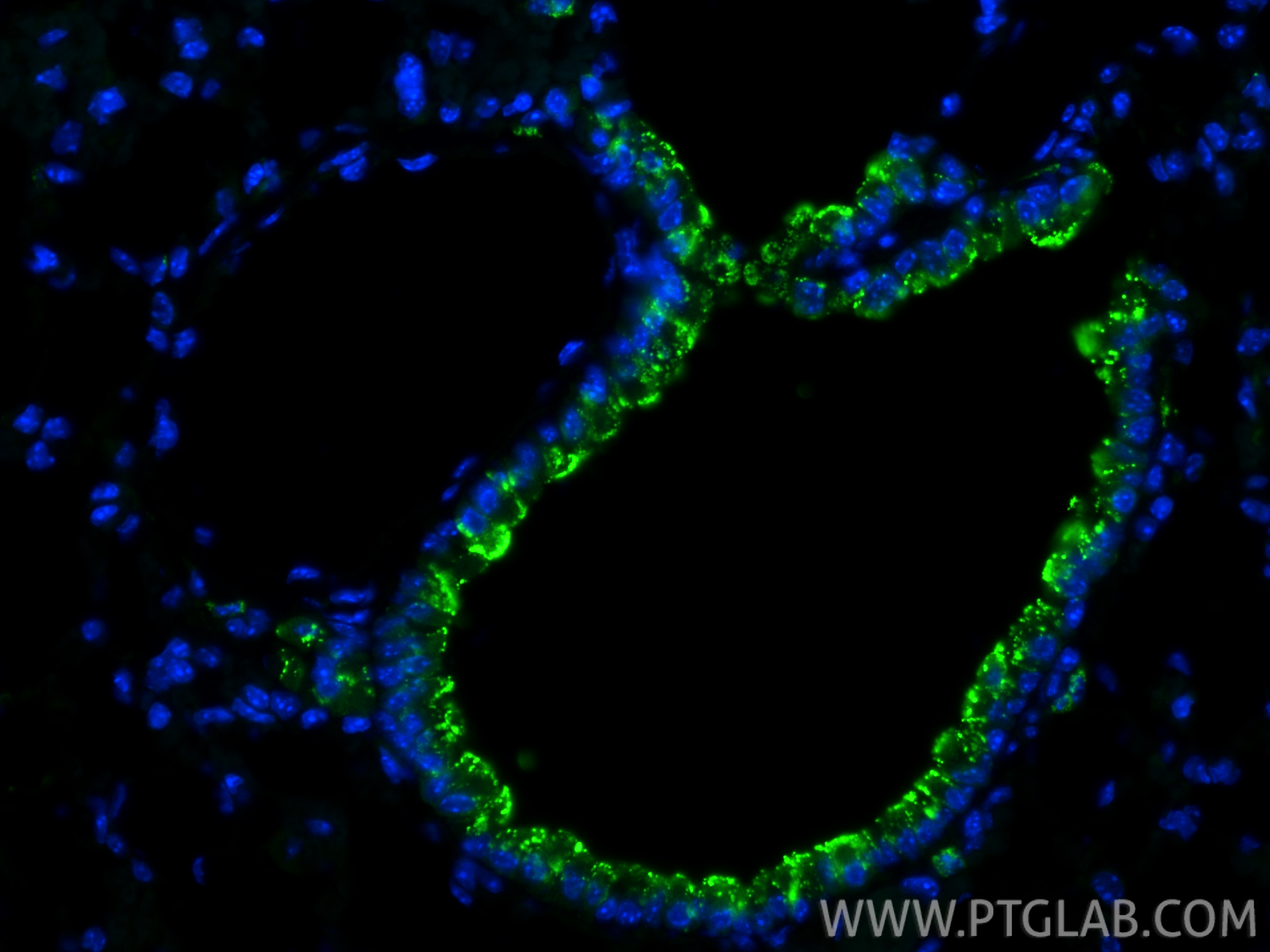 IF Staining of mouse lung using 21702-1-AP