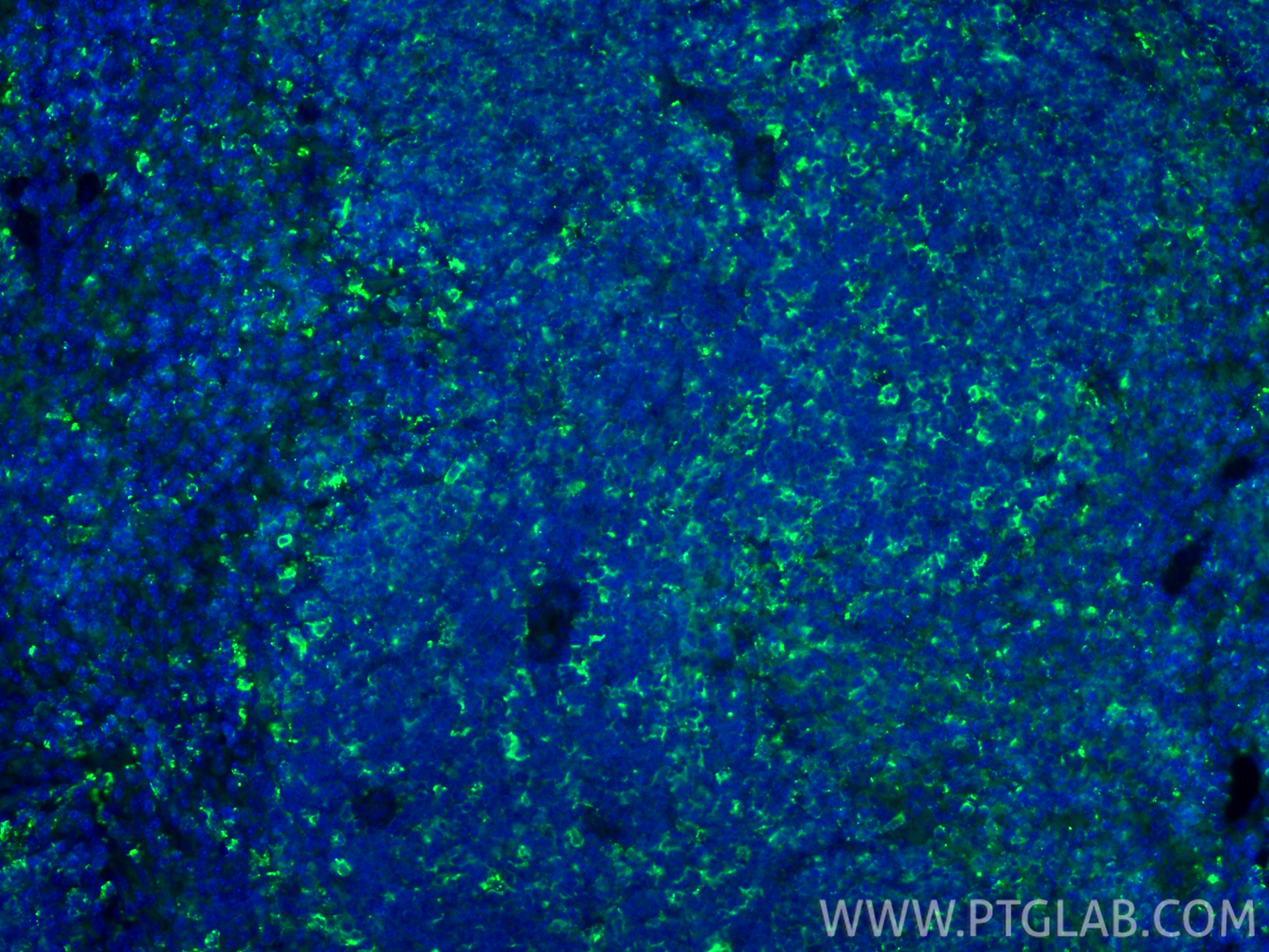 IF Staining of mouse spleen using 21702-1-AP