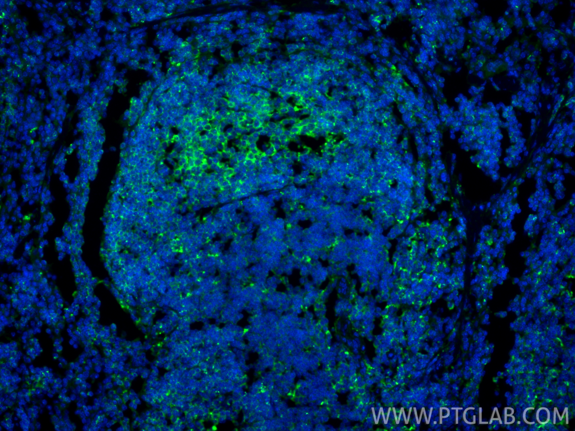 IF Staining of mouse spleen using 21702-1-AP IF Staining of mouse spleen using 21702-1-AP