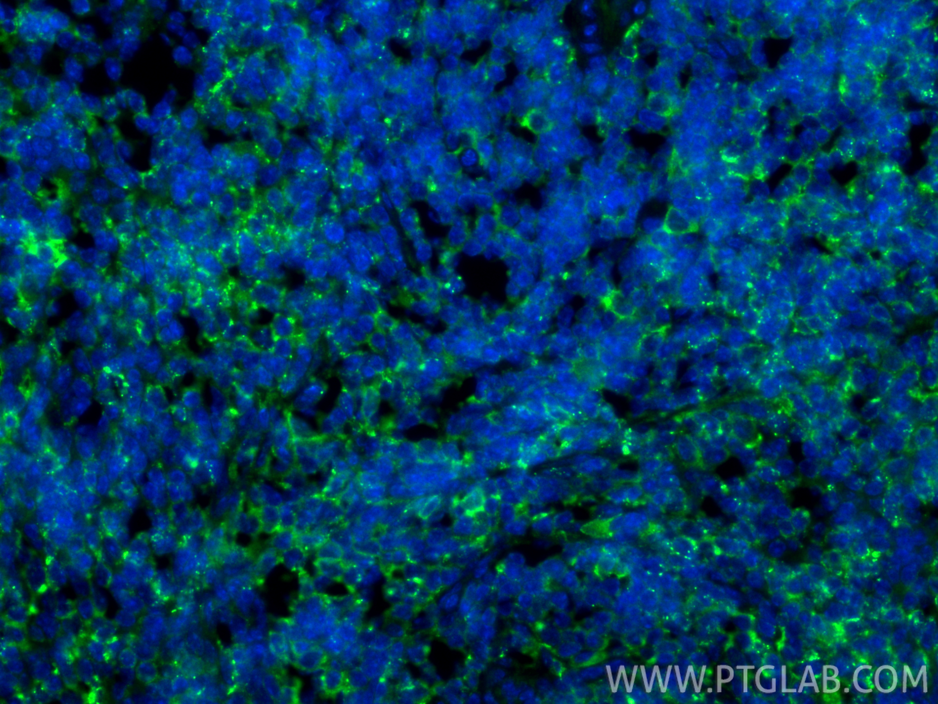 IF Staining of mouse spleen using 21702-1-AP IF Staining of mouse spleen using 21702-1-AP
