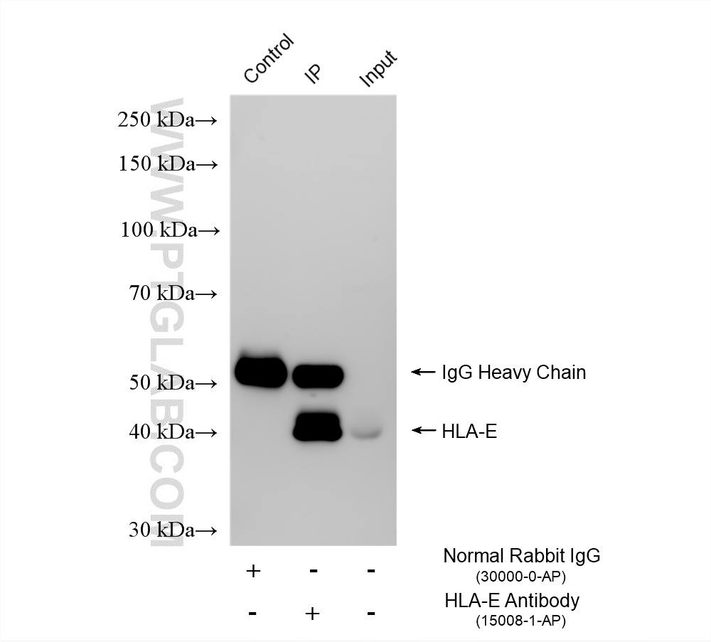IP result of anti-HLA-E (IP:15008-1-AP, 4ug; Detection:15008-1-AP 1:3000) with THP-1 cells lysate 1720 ug. IP experiment of THP-1 using 15008-1-AP
