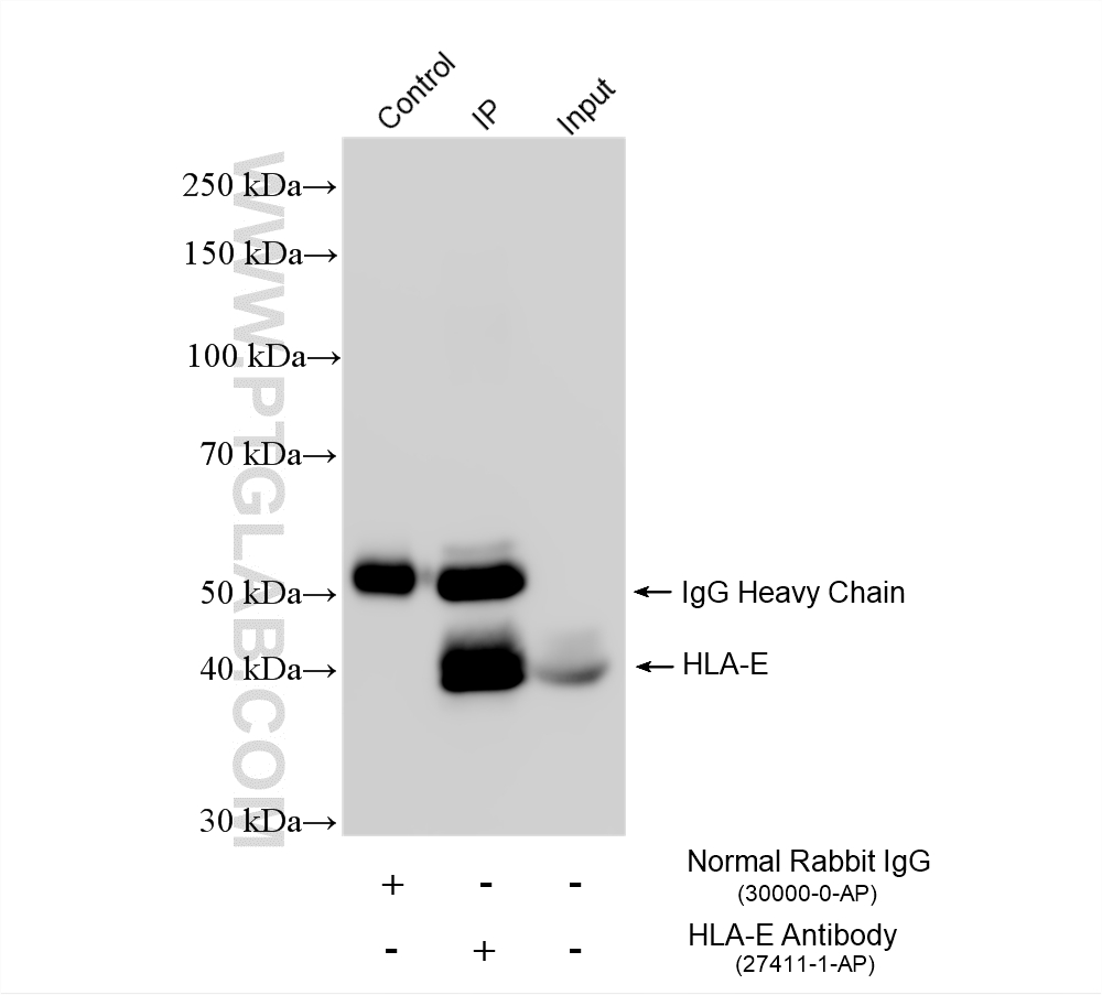 IP result of anti-HLA-E (IP:27411-1-AP, 4ug; Detection:27411-1-AP 1:4000) with THP-1 cells lysate 1720 ug. IP experiment of THP-1 using 27411-1-AP
