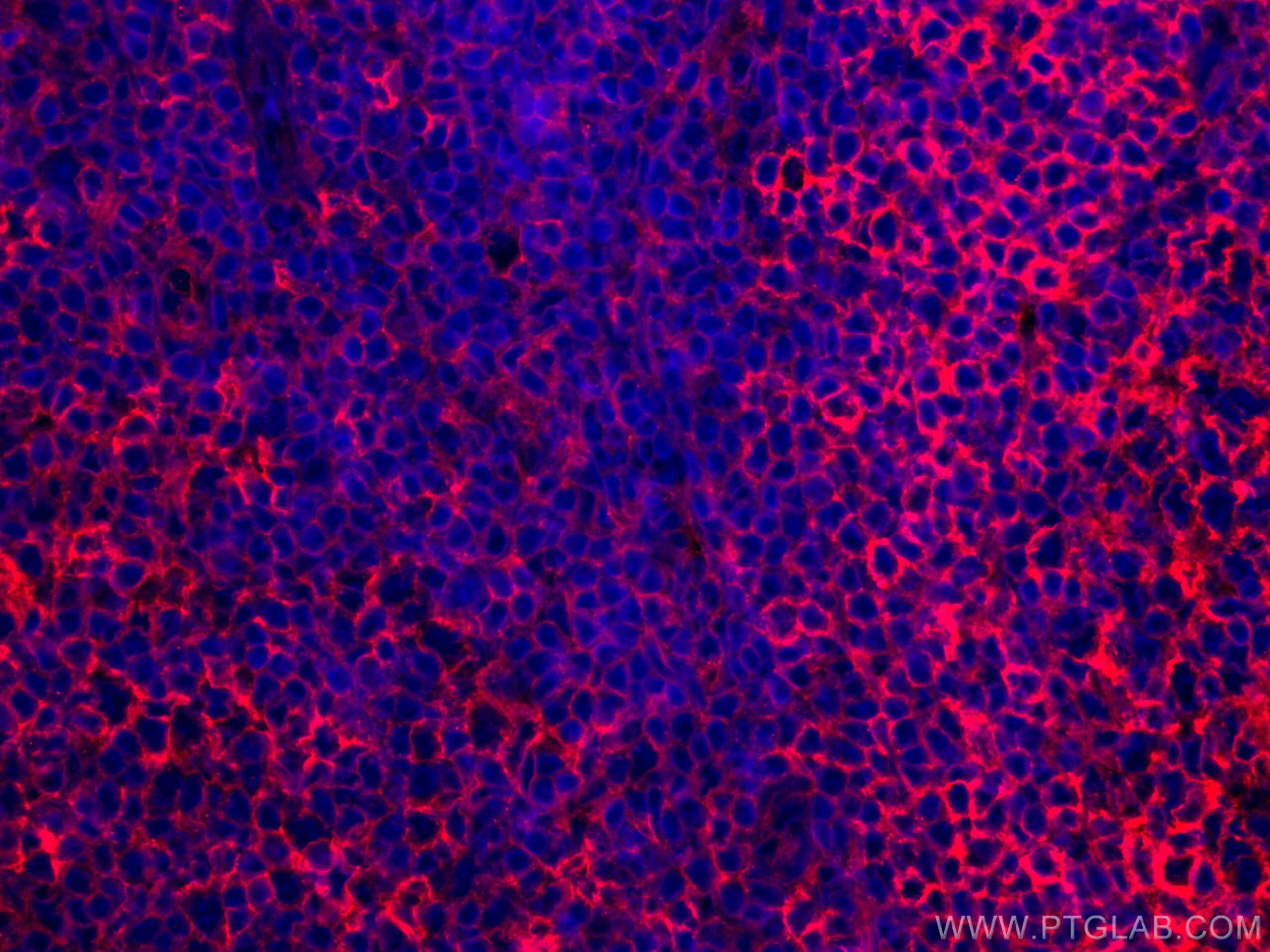 IF Staining of human tonsillitis using CL594-66530