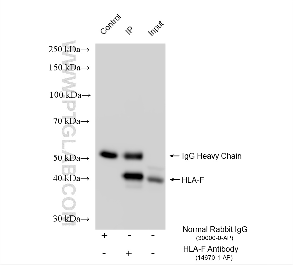 IP result of anti-HLA-F (IP:14670-1-AP, 4ug; Detection:14670-1-AP 1:3000) with A431 cells lysate 1040 ug. IP experiment of A431 using 14670-1-AP
