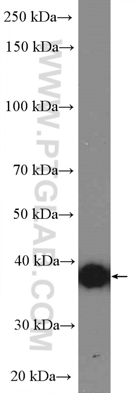 WB analysis of human placenta using 16913-1-AP