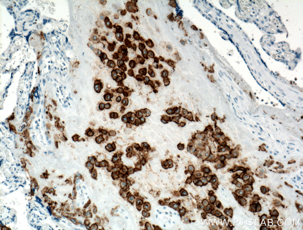 IHC staining of human placenta using 66447-1-Ig
